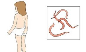 Sintomi di parassiti nel corpo umano