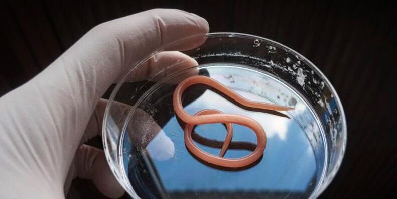 Ascaris è un elminto intestinale rotondo che vive nel sistema digestivo