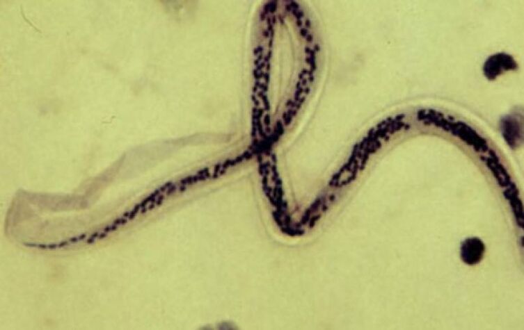 filaria dal corpo umano