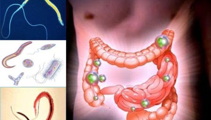 parassiti nell'intestino umano